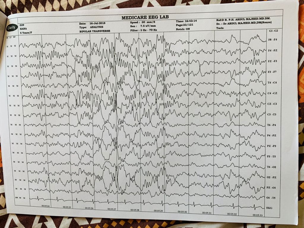 Patient Story